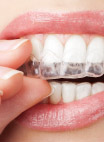 invisalign